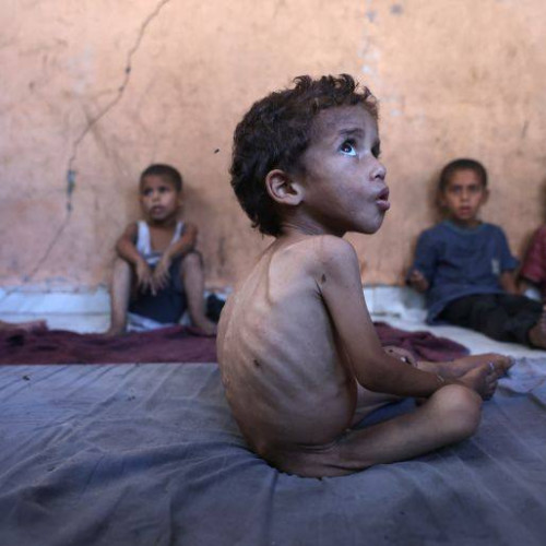 Foametea din Gaza, considerată de ONU ca fiind evitabilă