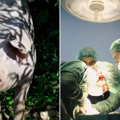 Primele transplanturi de plămân de porc la oameni, realizate în China