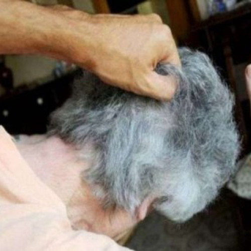 Octogenară bătută de fiu, internată cu multiple fracturi; instanța a dispus ordin de protecție