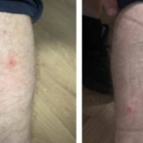 Ploșnițe în centrele de reținere din București, Europol reclamă condiții de muncă