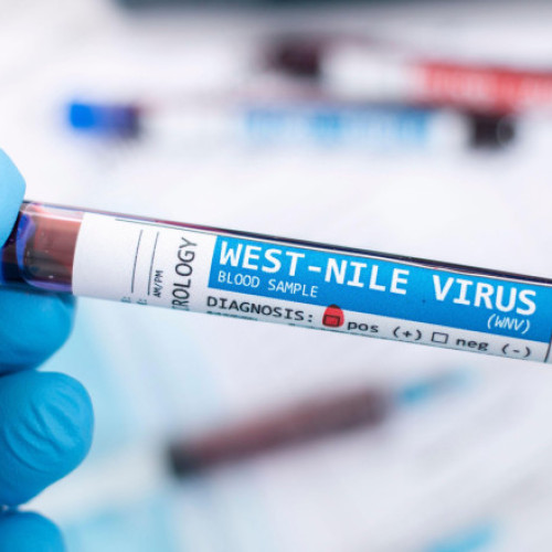 Restricții la donarea de sânge în România din cauza West Nile