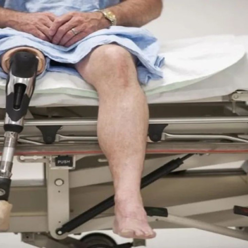 Chirurg britanic condamnat pentru fraudă după ce și-a provocat amputarea ambelor picioare