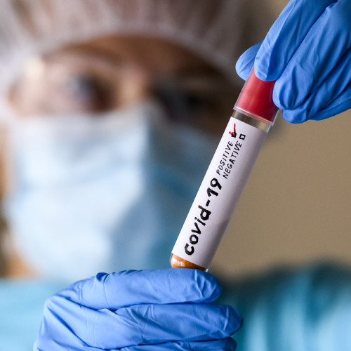 Numărul cazurilor COVID-19 în Sibiu scade în septembrie după vârf în august