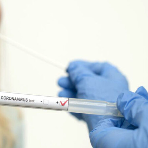 Scădere ușoară a cazurilor COVID-19 în perioada 8-14 septembrie