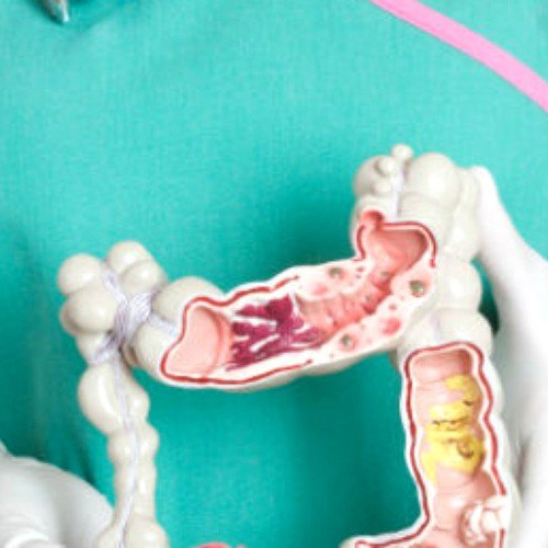 Creștere a cazurilor de boli inflamatorii intestinale în Iași și Nord-Estul României
