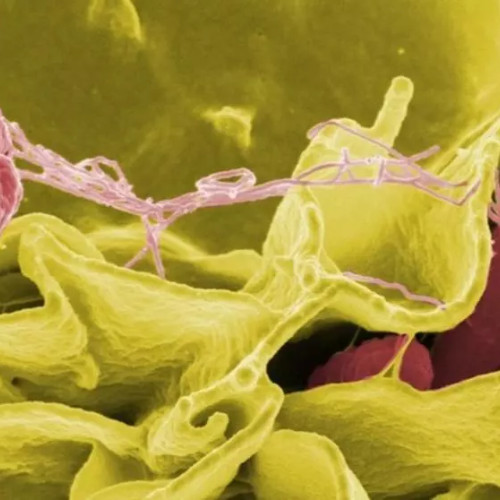 Ciuperca extrem de periculoasă Candidozyma auris se răspândește în spitalele europene