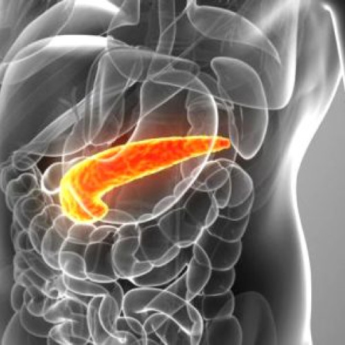 Neglijarea igienei orale crește riscul de cancer pancreatic de trei ori