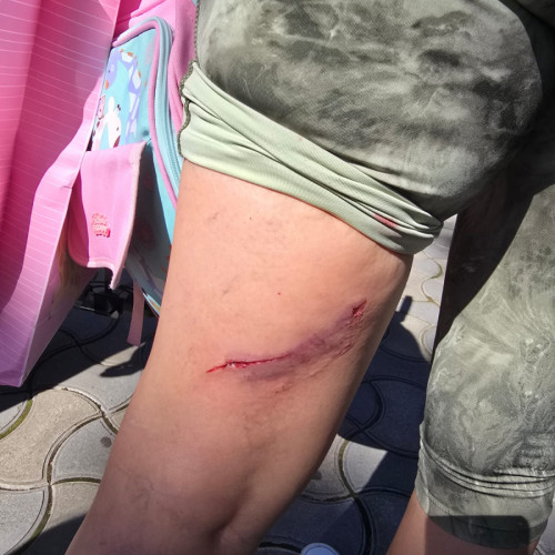 Proprietarul câinelui agresiv din Galați sancționat după atacul asupra unei mame nevăzătoare