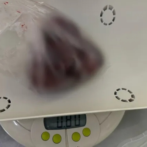 Intervenție chirurgicală complexă salvează viața unui nou-născut la Cluj