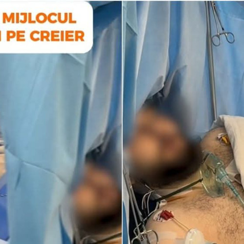 Pacient cântă la filarmonică în timpul unei operații pe creier