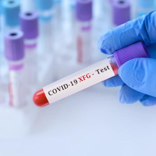 Noua variantă Stratus a COVID-19, simptome și situația actuală a cazurilor în România