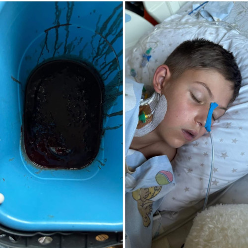 Copil de 10 ani din Petrila luptă pentru viață după hemoragii grave la inimă