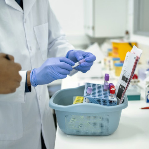 Infecția cu Clostridioides difficile: riscuri, transmitere și prevenție