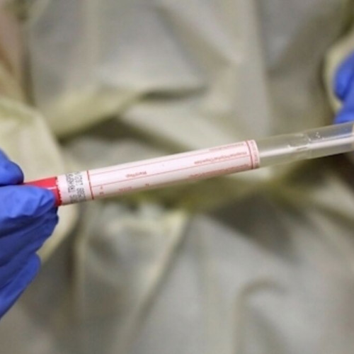 Varianta XFG a coronavirusului, sub monitorizare, provoacă forme ușoare de COVID-19