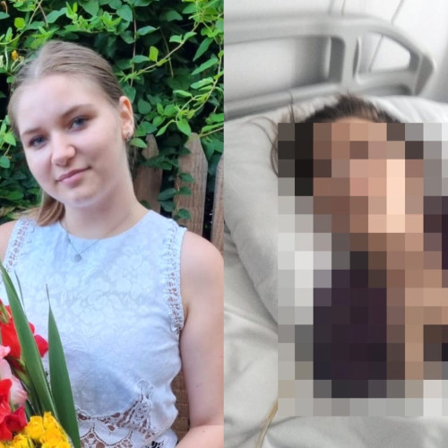 Andreea, tânăra care luptă după două stopuri cardio-respiratorii, are nevoie de ajutor