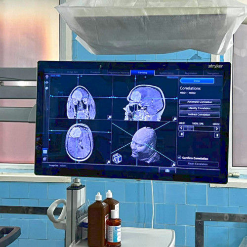 Primul spital din Galați a realizat operație pe creier cu neuronavigație