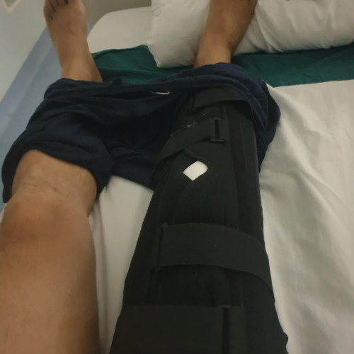 Bărbat cu genunchiul grav afectat după tratament neglijent la Botoșani