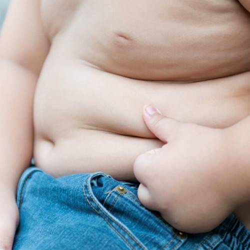 Dr. Eugenia Bratu avertizează asupra obezității la copiii din România