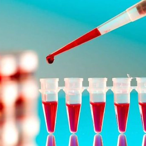 Testul Galleri a identificat peste 50 de tipuri de cancer în stadii incipiente