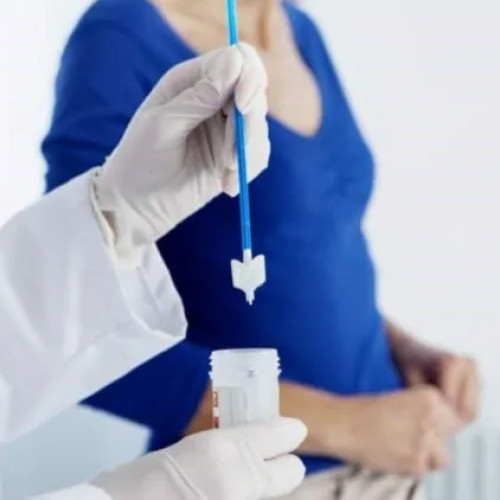 Testare gratuită Babeș-Papanicolau și HPV pentru femeile din Cluj