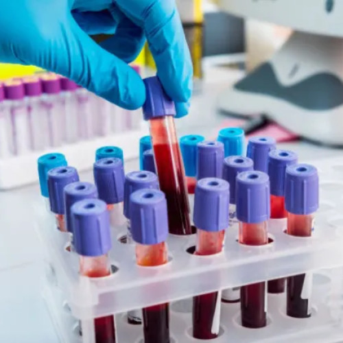 Ministerul Sănătății reamintește românilor dreptul la analize gratuite anuale