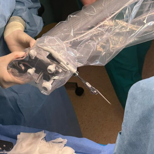 Iașul inaugurează implantarea cohleară asistată robotic în România