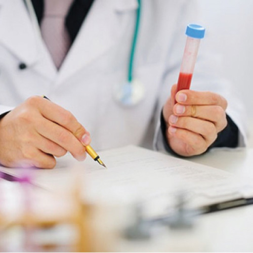 Generațiile tinere prezintă un risc crescut de cancer, arată un studiu american