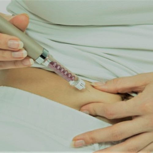 Celulele stomacului uman pot fi transformate pentru a produce insulină împotriva diabetului