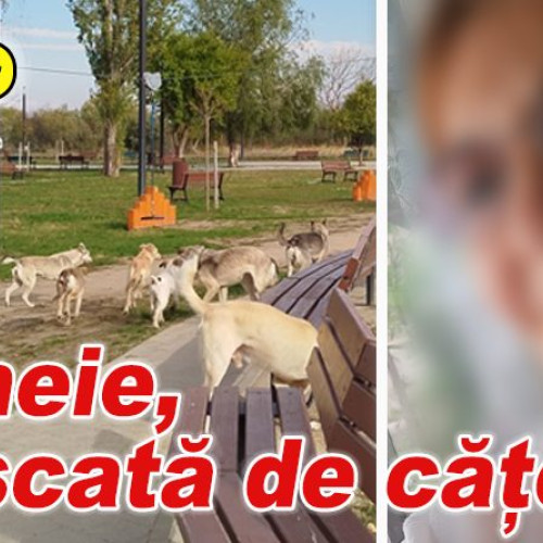Femeie din Buzău mușcată de cățea în Parcul Tineretului