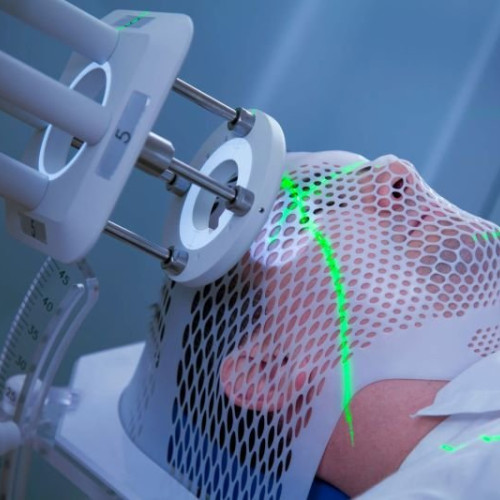 Un model 3D al creierului uman oferă avan­taje pentru studiul bolilor neurologice