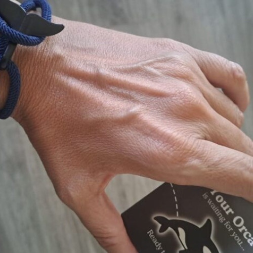 Profesoara Monica Mocanu susține protecția animalelor marine cu o brățară specială