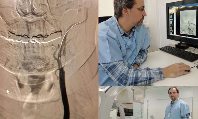 Premiere la Spitalul Județean Buzău: angioplastie carotidiană și subclavie realizate cu succes