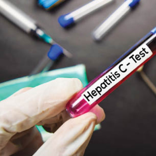 Testarea gratuită pentru hepatita B și C este disponibilă pentru toți pacienții cu simptome