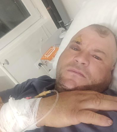 Cioban agresat pe teren pășunat cu acordul proprietarului din Densuș