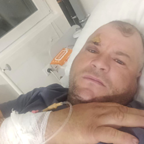 Cioban agresat pe teren pășunat cu acordul proprietarului din Densuș