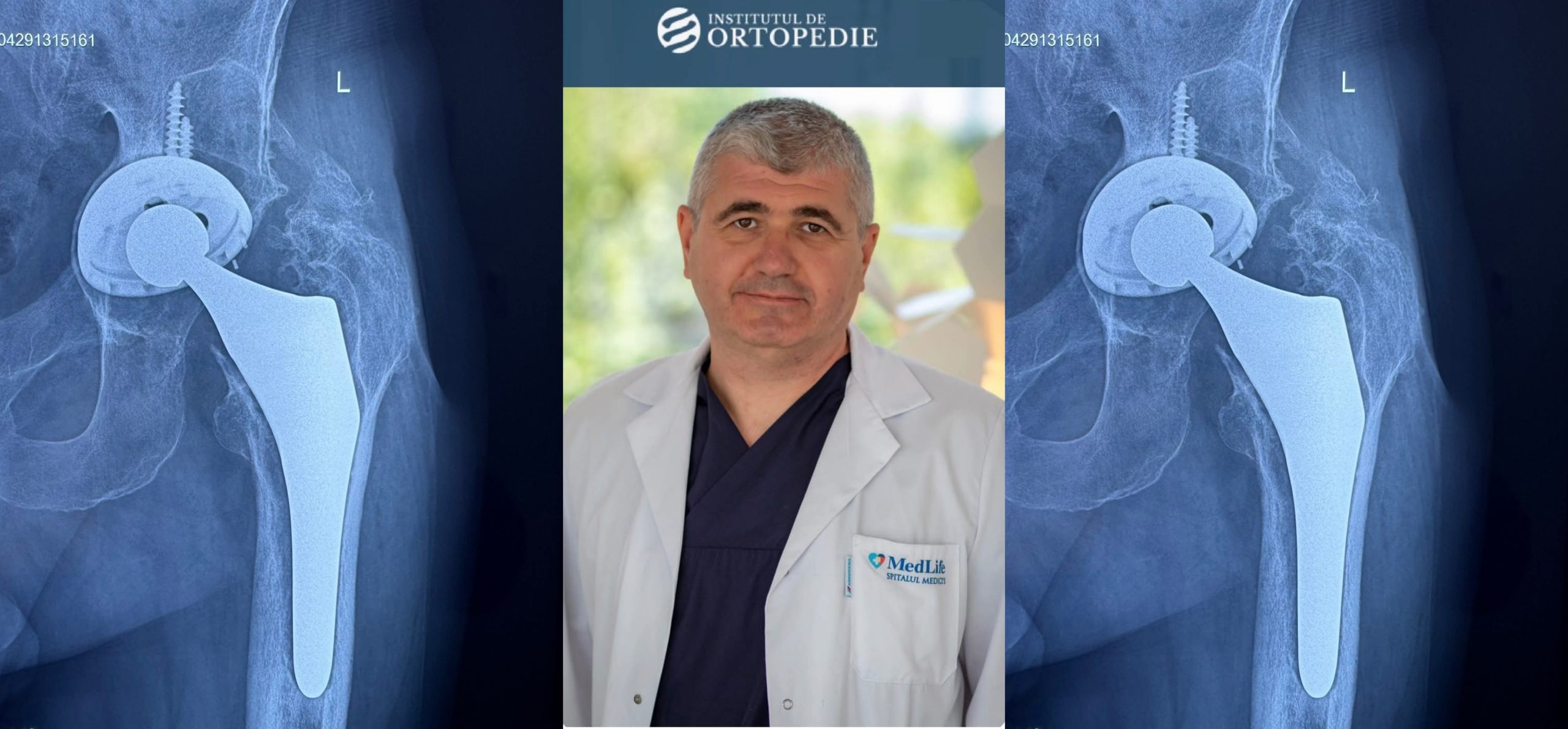 Un bărbat de 87 de ani își recapătă mobilitatea după o operație ortopedică complexă