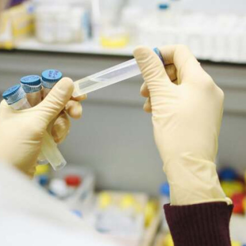 Două cazuri confirmate de lepră la un salon SPA din Cluj-Napoca