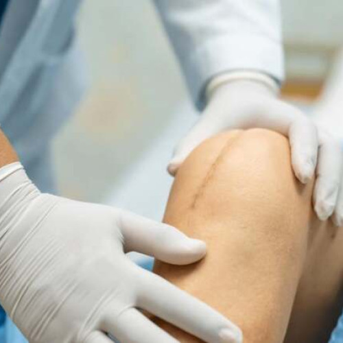 Recuperarea medicală, esențială după intervenții ortopedice pentru refacerea mobilității