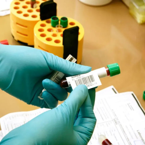 Pacienții peste 40 de ani pot face analize medicale gratuite fără limite de buget