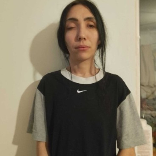 Alexandra Simion, tânăra nevăzătoare care încearcă să își recapete vederea după șase ani