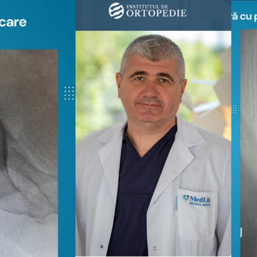 Chirurgul Bogdan Niculescu realizează o operație complexă de șold