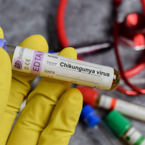Primul caz de virus Chikungunya confirmat în România