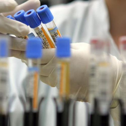 Terapia combinată promite tratamente eficiente împotriva cancerului pancreatic