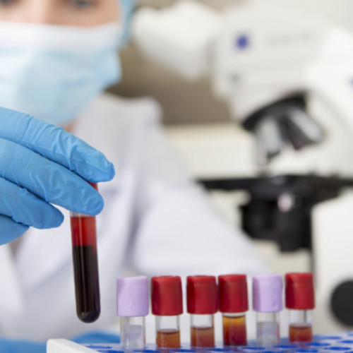 Atenție la expunerea la metale grele: efecte asupra sănătății