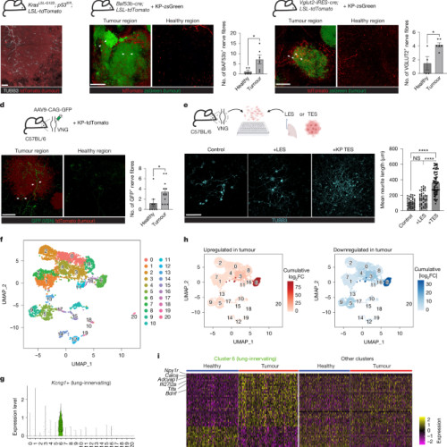 Descoperire majoră în comunicarea tumoră-creier: rolul nervei vagale