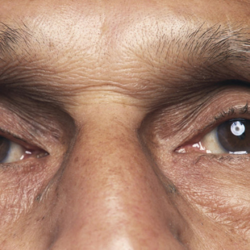 O bacterie ar putea influența declinul cognitiv și boala Alzheimer