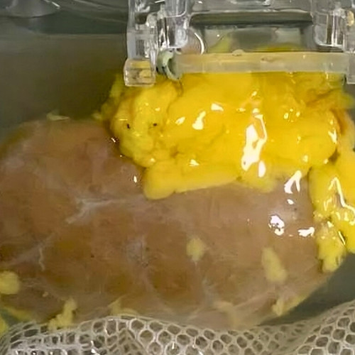 Punct de cotitură: O echipă de cercetători a creat un rinichi 'universal' pentru orice grupă de sânge