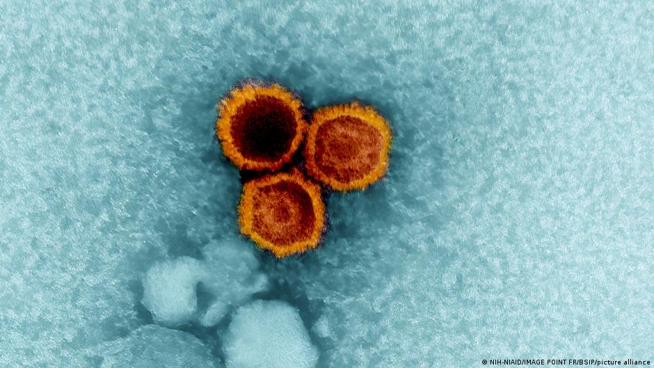 Cum virusul Epstein-Barr declanșează scleroza multiplă la unii oameni