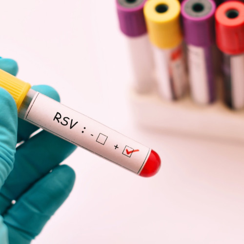 RSV se răspândește în New Jersey. Află ce județe au cele mai ridicate niveluri.