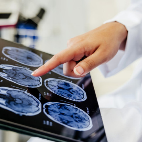 Pacienții asigurați vor avea dreptul la o a doua opinie medicală